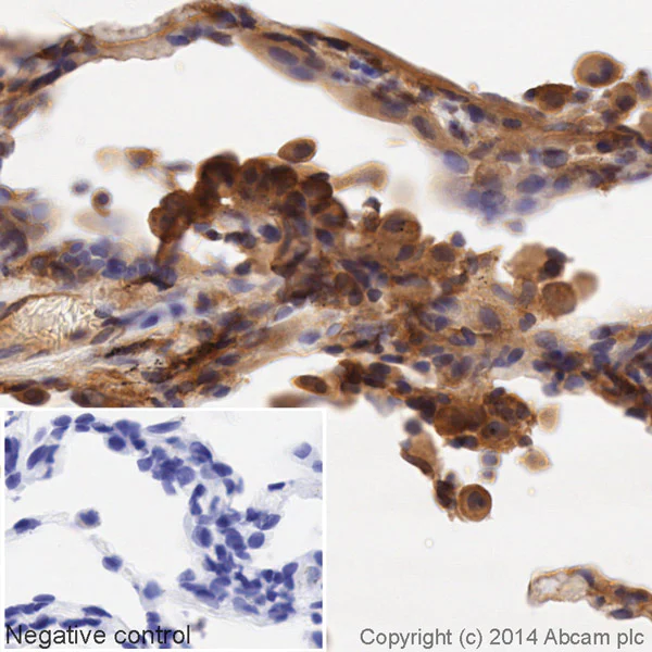 Immunohistochemistry (Formalin/PFA-fixed paraffin-embedded sections) - HRP Anti-CD14 antibody [EPR3653] (AB195525)