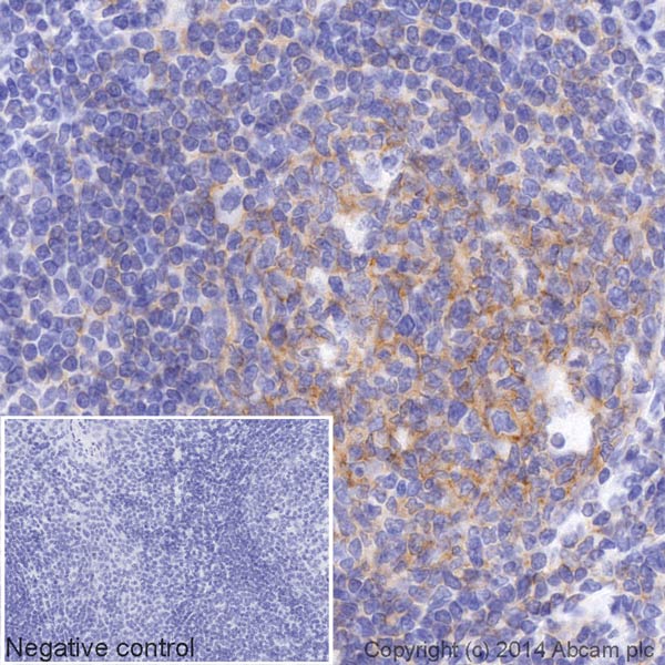 Immunohistochemistry (Formalin/PFA-fixed paraffin-embedded sections) - HRP Anti-CD19 antibody [EPR5906] (AB195896), expandable thumbnail