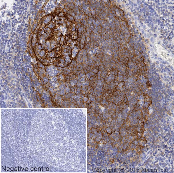 Immunohistochemistry (Formalin/PFA-fixed paraffin-embedded sections) - HRP Anti-CD21 antibody [EP3093] (AB202354), expandable thumbnail