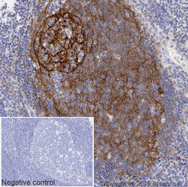 Immunohistochemistry (Formalin/PFA-fixed paraffin-embedded sections) - HRP Anti-CD21 antibody [EP3093] (AB202354)