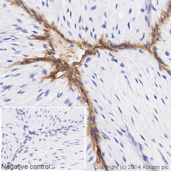 Immunohistochemistry (Formalin/PFA-fixed paraffin-embedded sections) - HRP Anti-CD34 antibody [EP373Y] (AB195017)