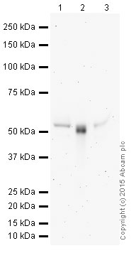 Western blot - HRP Anti-CD4 antibody [EPR6855] (AB195842), expandable thumbnail