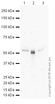 Western blot - HRP Anti-CD4 antibody [EPR6855] (AB195842)