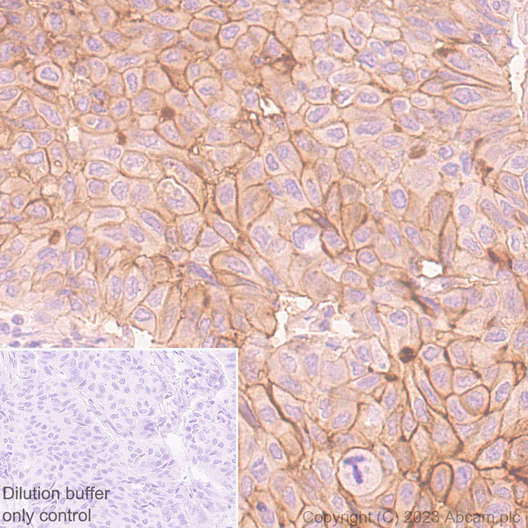 Immunohistochemistry (Formalin/PFA-fixed paraffin-embedded sections) - HRP Anti-CD55 antibody [EPR6689] (AB309977)