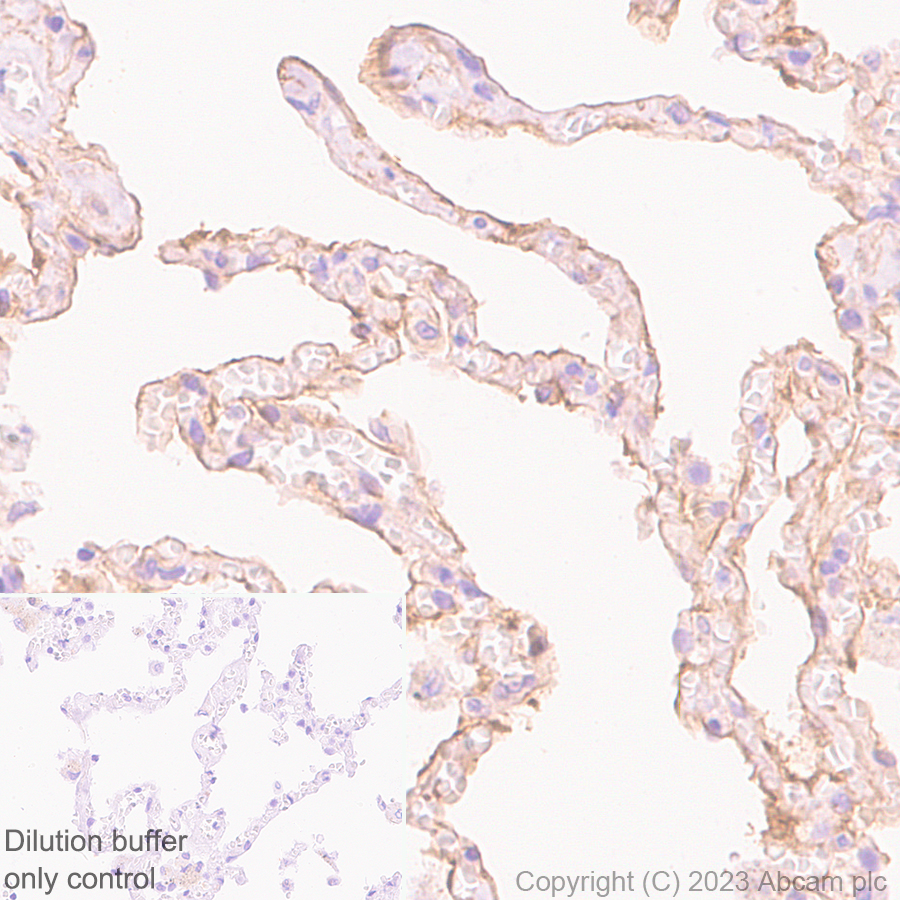 Immunohistochemistry (Formalin/PFA-fixed paraffin-embedded sections) - HRP Anti-CD55 antibody [EPR6689] (AB309977), expandable thumbnail