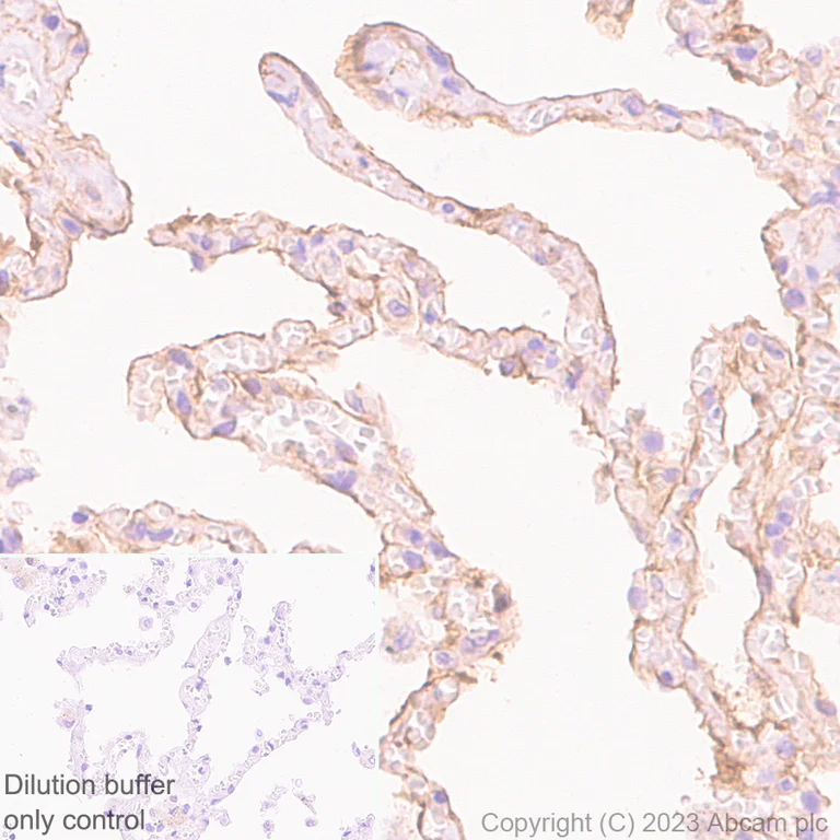 Immunohistochemistry (Formalin/PFA-fixed paraffin-embedded sections) - HRP Anti-CD55 antibody [EPR6689] (AB309977)