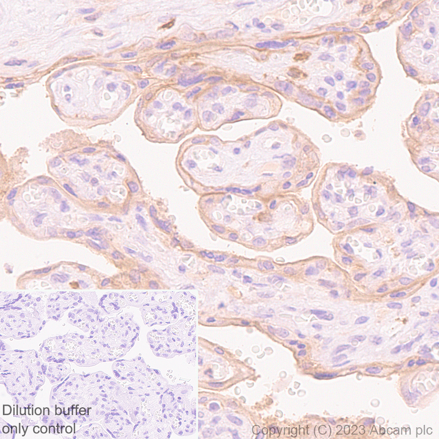Immunohistochemistry (Formalin/PFA-fixed paraffin-embedded sections) - HRP Anti-CD55 antibody [EPR6689] (AB309977), expandable thumbnail