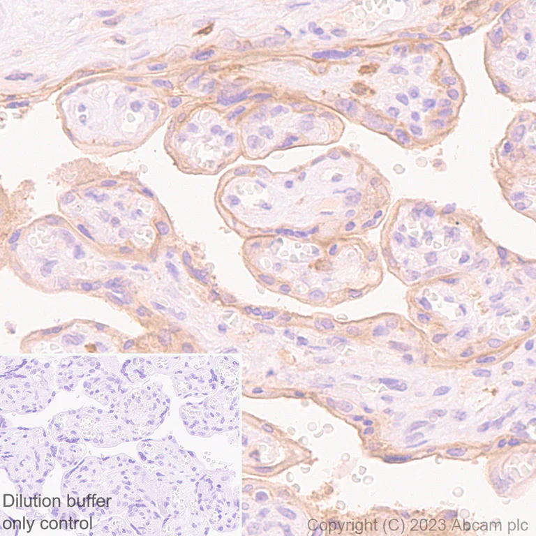 Immunohistochemistry (Formalin/PFA-fixed paraffin-embedded sections) - HRP Anti-CD55 antibody [EPR6689] (AB309977)