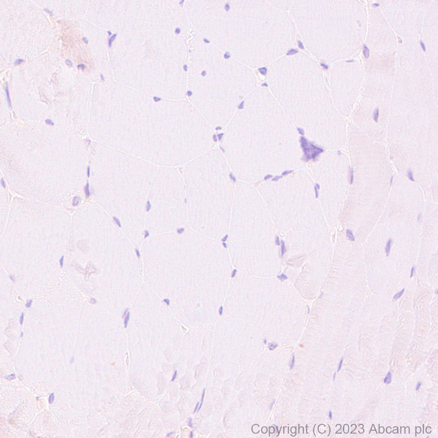 Immunohistochemistry (Formalin/PFA-fixed paraffin-embedded sections) - HRP Anti-CD55 antibody [EPR6689] (AB309977), expandable thumbnail