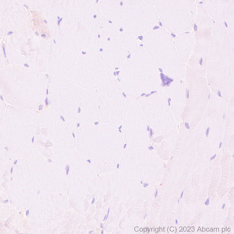 Immunohistochemistry (Formalin/PFA-fixed paraffin-embedded sections) - HRP Anti-CD55 antibody [EPR6689] (AB309977)