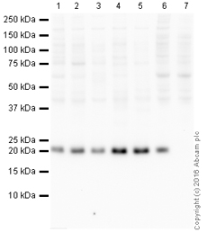 Western blot - HRP Anti-CDC42 antibody [EPR15620] (AB215810), expandable thumbnail