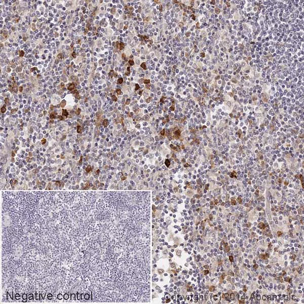 Immunohistochemistry (Formalin/PFA-fixed paraffin-embedded sections) - HRP Anti-CDK1 + CDK2 + CDK3 (phospho T14) antibody [E161] (AB193834)