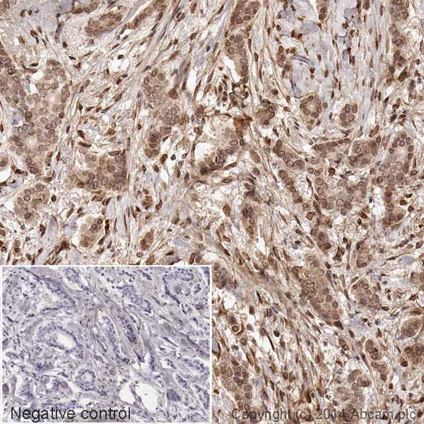 Immunohistochemistry (Formalin/PFA-fixed paraffin-embedded sections) - HRP Anti-Cdk4 antibody [EPR4513-32-7] (AB193968)