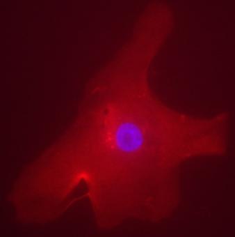 Immunocytochemistry/ Immunofluorescence - HRP Anti-CHREBP antibody (AB81958)