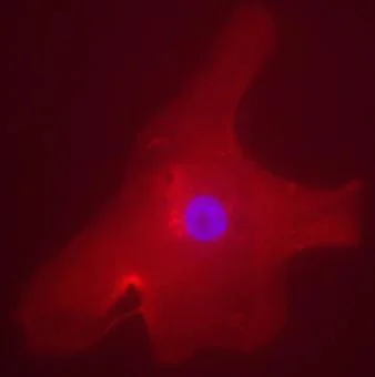 Immunocytochemistry/ Immunofluorescence - HRP Anti-CHREBP antibody (AB81958)