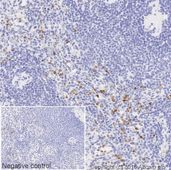 Immunohistochemistry (Formalin/PFA-fixed paraffin-embedded sections) - HRP Anti-cIAP1 antibody [EPR4673] (AB207526)