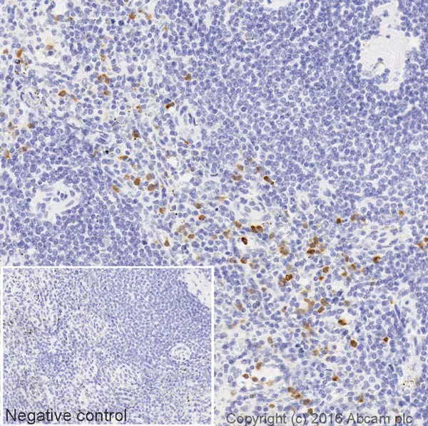 Immunohistochemistry (Formalin/PFA-fixed paraffin-embedded sections) - HRP Anti-cIAP1 antibody [EPR4673] (AB207526)