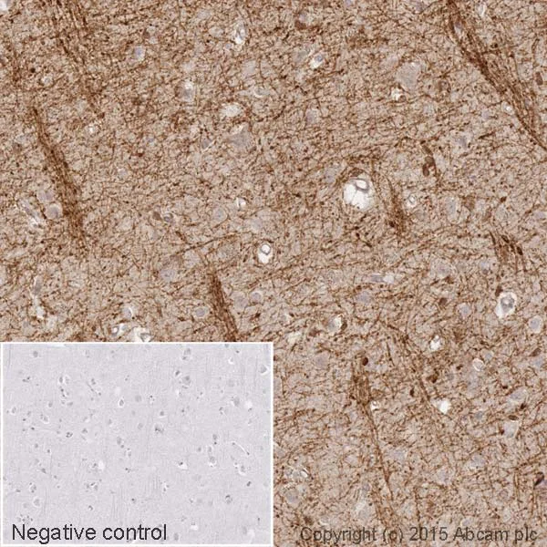 Immunohistochemistry (Formalin/PFA-fixed paraffin-embedded sections) - HRP Anti-CNPase antibody [11-5B] (AB201678)