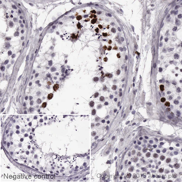 Immunohistochemistry (Formalin/PFA-fixed paraffin-embedded sections) - HRP Anti-Coilin antibody [IH10] (AB196715)