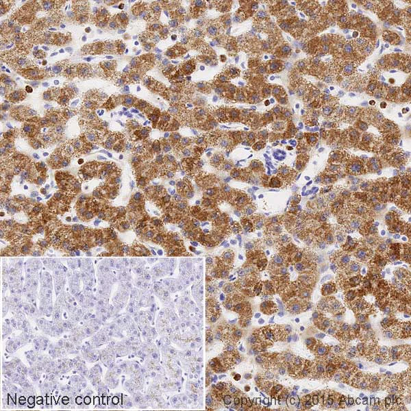 Immunohistochemistry (Formalin/PFA-fixed paraffin-embedded sections) - HRP Anti-CPS1 antibody [EPR7493-3] (AB198969)