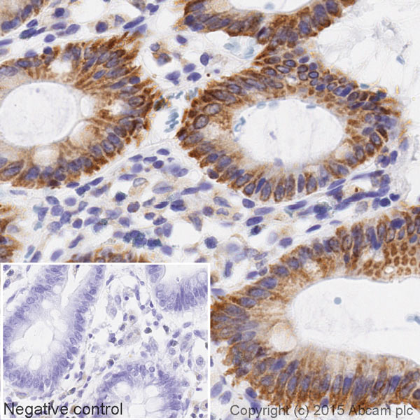 Immunohistochemistry (Formalin/PFA-fixed paraffin-embedded sections) - HRP Anti-CPT1A antibody [8F6AE9] (AB198494), expandable thumbnail