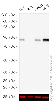 Western blot - HRP Anti-CPT1A antibody [8F6AE9] (AB198494), expandable thumbnail