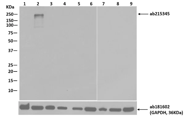 Western blot - HRP Anti-CRISPR-Cas9 antibody [EPR18991] (AB215345)