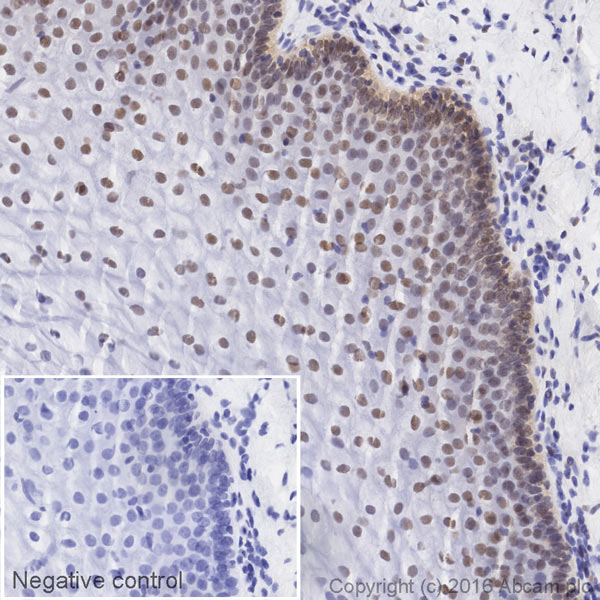 Immunohistochemistry (Formalin/PFA-fixed paraffin-embedded sections) - HRP Anti-CtBP1 antibody [EPR6800] (AB208244), expandable thumbnail