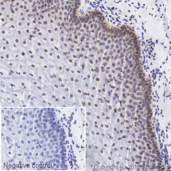 Immunohistochemistry (Formalin/PFA-fixed paraffin-embedded sections) - HRP Anti-CtBP1 antibody [EPR6800] (AB208244)