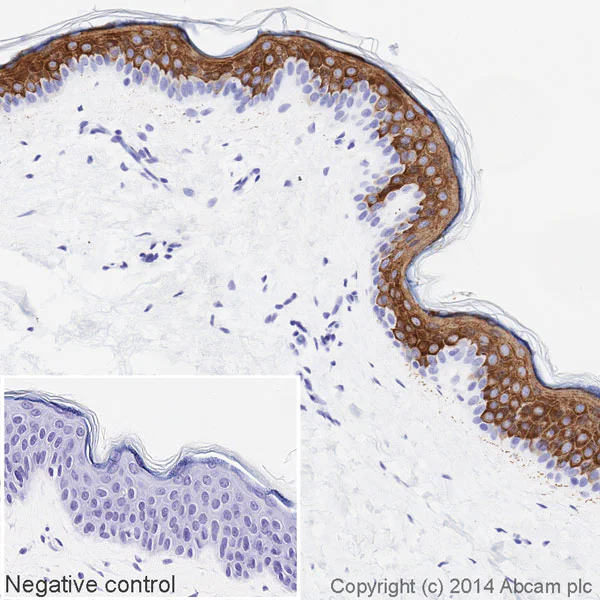 Immunohistochemistry (Formalin/PFA-fixed paraffin-embedded sections) - HRP Anti-Cytokeratin 10 antibody [EP1607IHCY] (AB194232)