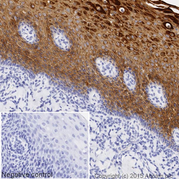 Immunohistochemistry (Formalin/PFA-fixed paraffin-embedded sections) - HRP Anti-Cytokeratin 13 antibody [EPR3671] (AB199092), expandable thumbnail