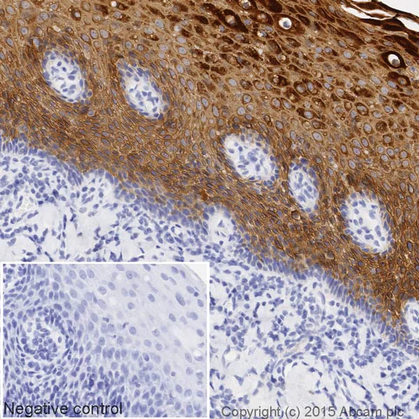 Immunohistochemistry (Formalin/PFA-fixed paraffin-embedded sections) - HRP Anti-Cytokeratin 13 antibody [EPR3671] (AB199092)