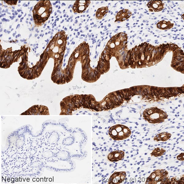 Immunohistochemistry (Formalin/PFA-fixed paraffin-embedded sections) - HRP Anti-Cytokeratin 19 antibody [EP1580Y] (AB193600)