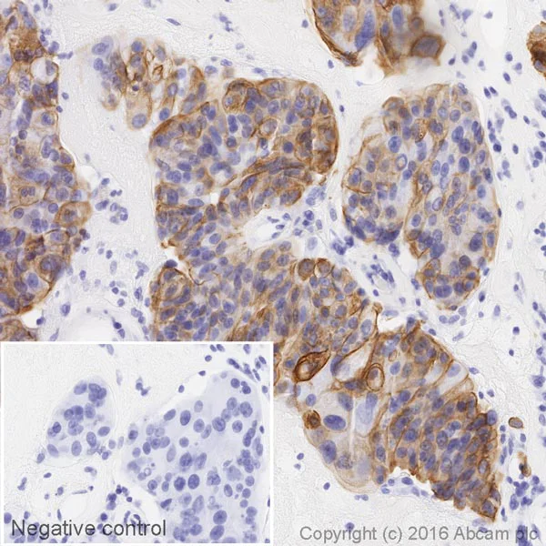 Immunohistochemistry (Formalin/PFA-fixed paraffin-embedded sections) - HRP Anti-Cytokeratin 7 antibody [EPR17078] (AB209945)