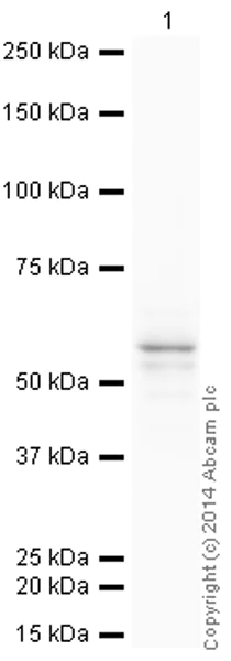 Western blot - HRP Anti-Cytokeratin 8 antibody [EP1628Y] (AB193094)