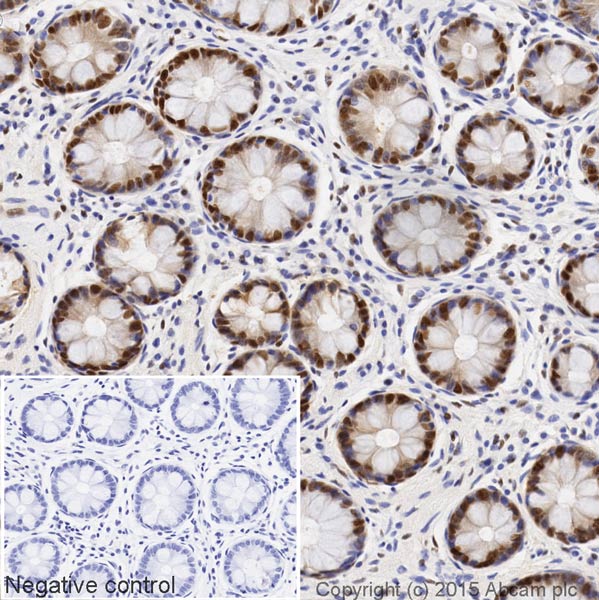 Immunohistochemistry (Formalin/PFA-fixed paraffin-embedded sections) - HRP Anti-DDB1 antibody [EPR6089] (AB199026)