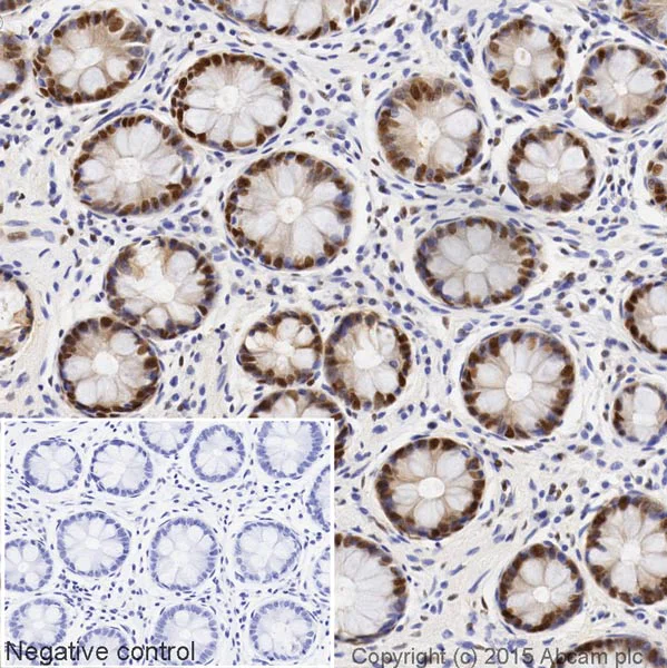 Immunohistochemistry (Formalin/PFA-fixed paraffin-embedded sections) - HRP Anti-DDB1 antibody [EPR6089] (AB199026)