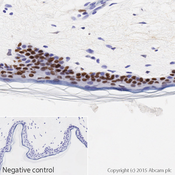 Immunohistochemistry (Formalin/PFA-fixed paraffin-embedded sections) - HRP Anti-DDB2 antibody [EPR9811] (AB205484)