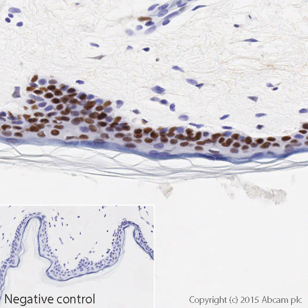 Immunohistochemistry (Formalin/PFA-fixed paraffin-embedded sections) - HRP Anti-DDB2 antibody [EPR9811] (AB205484)