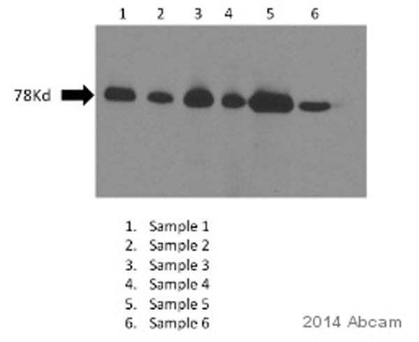 Western blot - HRP Anti-DDDDK tag (Binds to FLAG® tag sequence) antibody [M2] (AB49763), expandable thumbnail