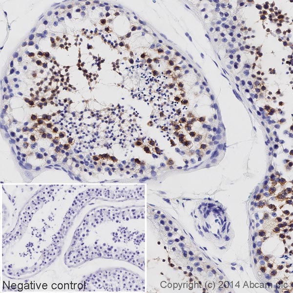 Immunohistochemistry (Formalin/PFA-fixed paraffin-embedded sections) - HRP Anti-DDX4 / MVH antibody [mAbcam27591] (AB196709)