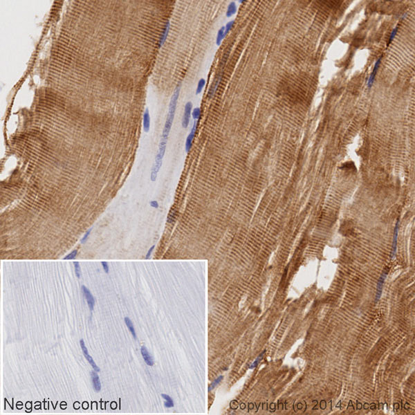 Immunohistochemistry (Formalin/PFA-fixed paraffin-embedded sections) - HRP Anti-Desmin antibody [Y66] - Cytoskeleton Marker (AB195178)