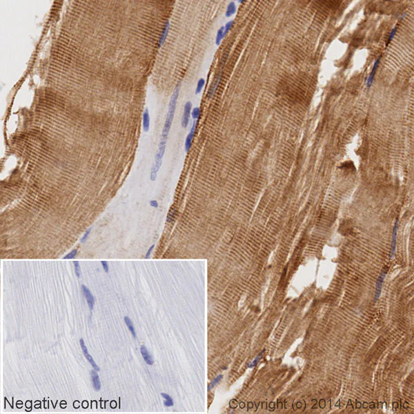 Immunohistochemistry (Formalin/PFA-fixed paraffin-embedded sections) - HRP Anti-Desmin antibody [Y66] - Cytoskeleton Marker (AB195178)