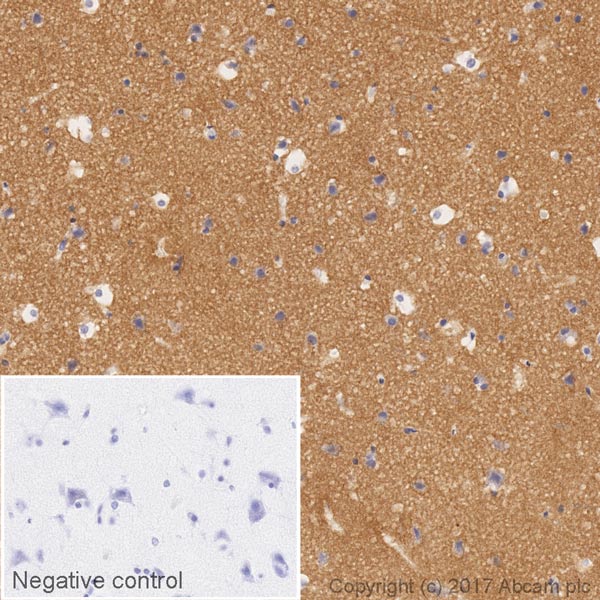 Immunohistochemistry (Formalin/PFA-fixed paraffin-embedded sections) - HRP Anti-Dynamin 1 antibody [EP801Y] (AB207511)