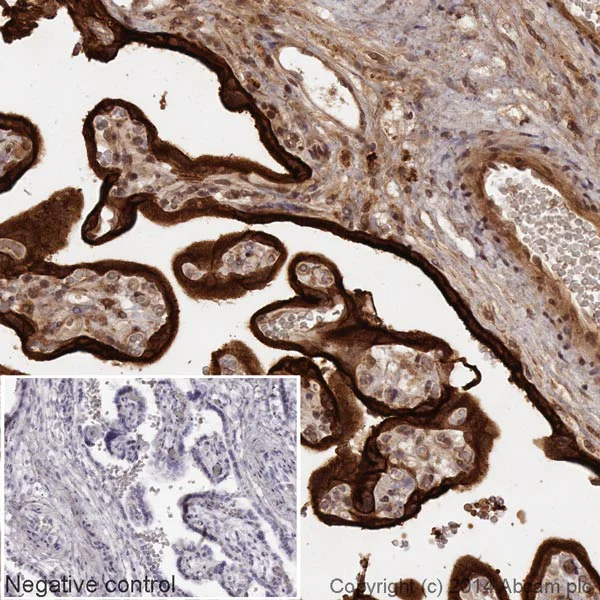 Immunohistochemistry (Formalin/PFA-fixed paraffin-embedded sections) - HRP Anti-EGFR antibody [EP38Y] (AB193602)