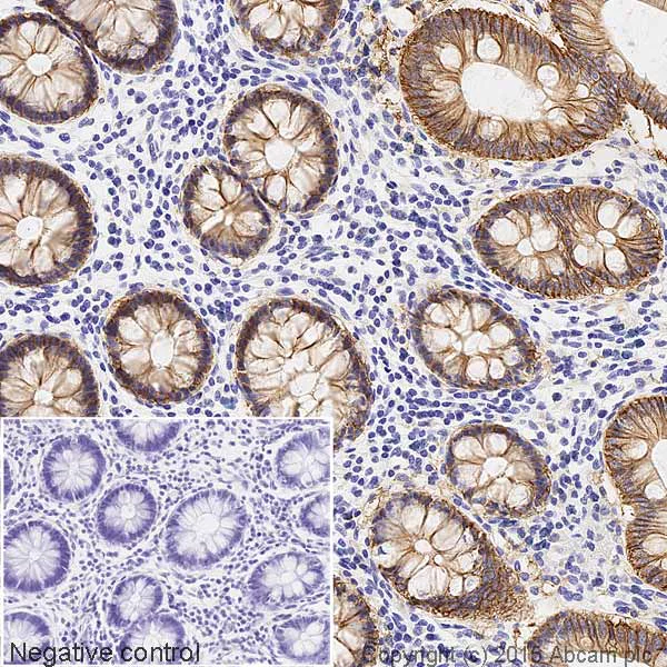 Immunohistochemistry (Formalin/PFA-fixed paraffin-embedded sections) - HRP Anti-EpCAM antibody [EPR677(2)] (AB199521)