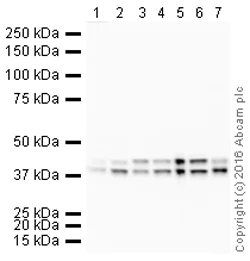 Western blot - HRP Anti-ERK1 + ERK2 antibody [EPR17526] (AB209321)