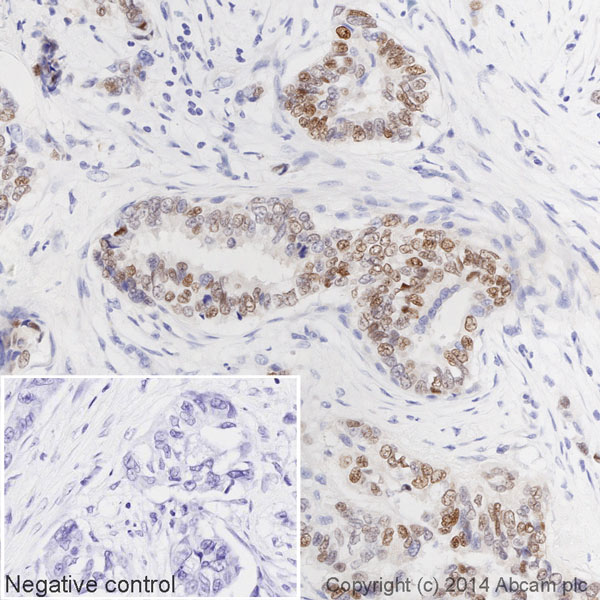 Immunohistochemistry (Formalin/PFA-fixed paraffin-embedded sections) - HRP Anti-Estrogen Receptor alpha antibody [E115] (AB194152), expandable thumbnail