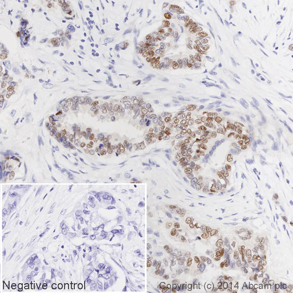 Immunohistochemistry (Formalin/PFA-fixed paraffin-embedded sections) - HRP Anti-Estrogen Receptor alpha antibody [E115] (AB194152)