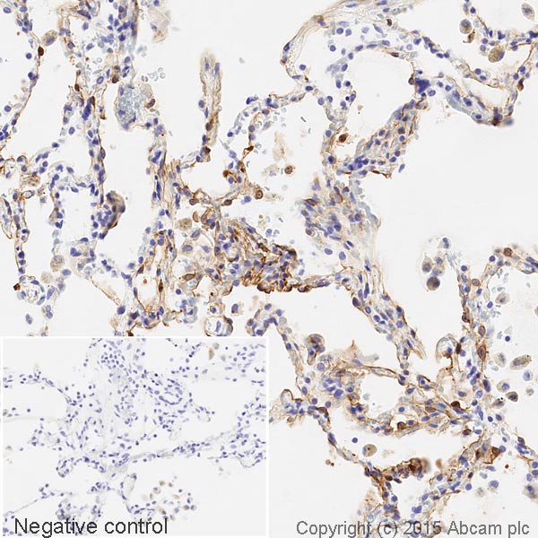 Immunohistochemistry (Formalin/PFA-fixed paraffin-embedded sections) - HRP Anti-Ezrin antibody [EP886Y] (AB198522), expandable thumbnail